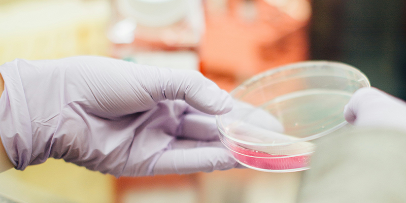 活菌計數(shù)效率瓶頸如何破？博大博聚微生物細胞計數(shù)儀的實踐方案