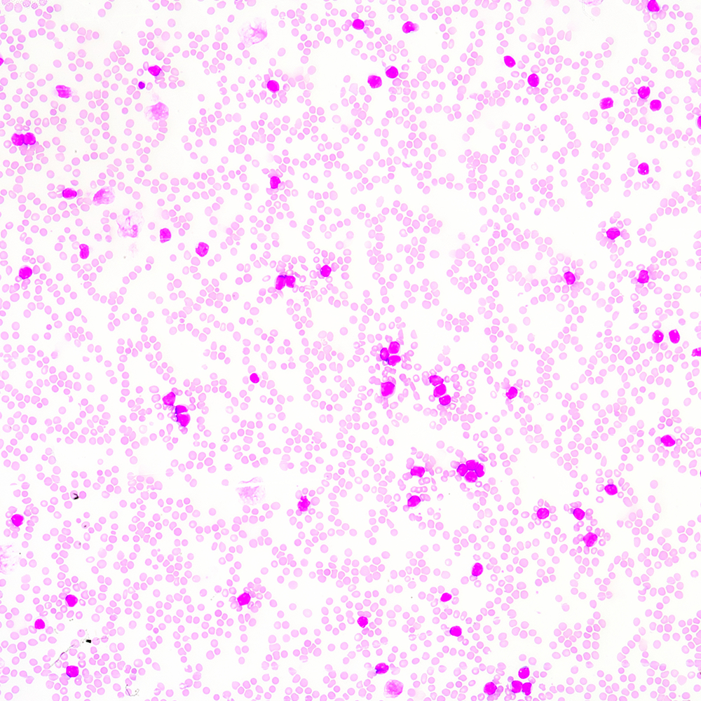 臺盼藍 VS AOPI：細胞活率計數(shù)，哪種染色更合你意？