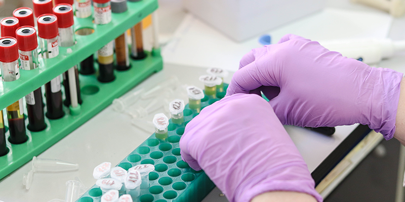 十年長青！博大博聚JSY型全自動細胞計數(shù)儀：憑什么成科研人心中的細胞計數(shù) “經(jīng)典款”？